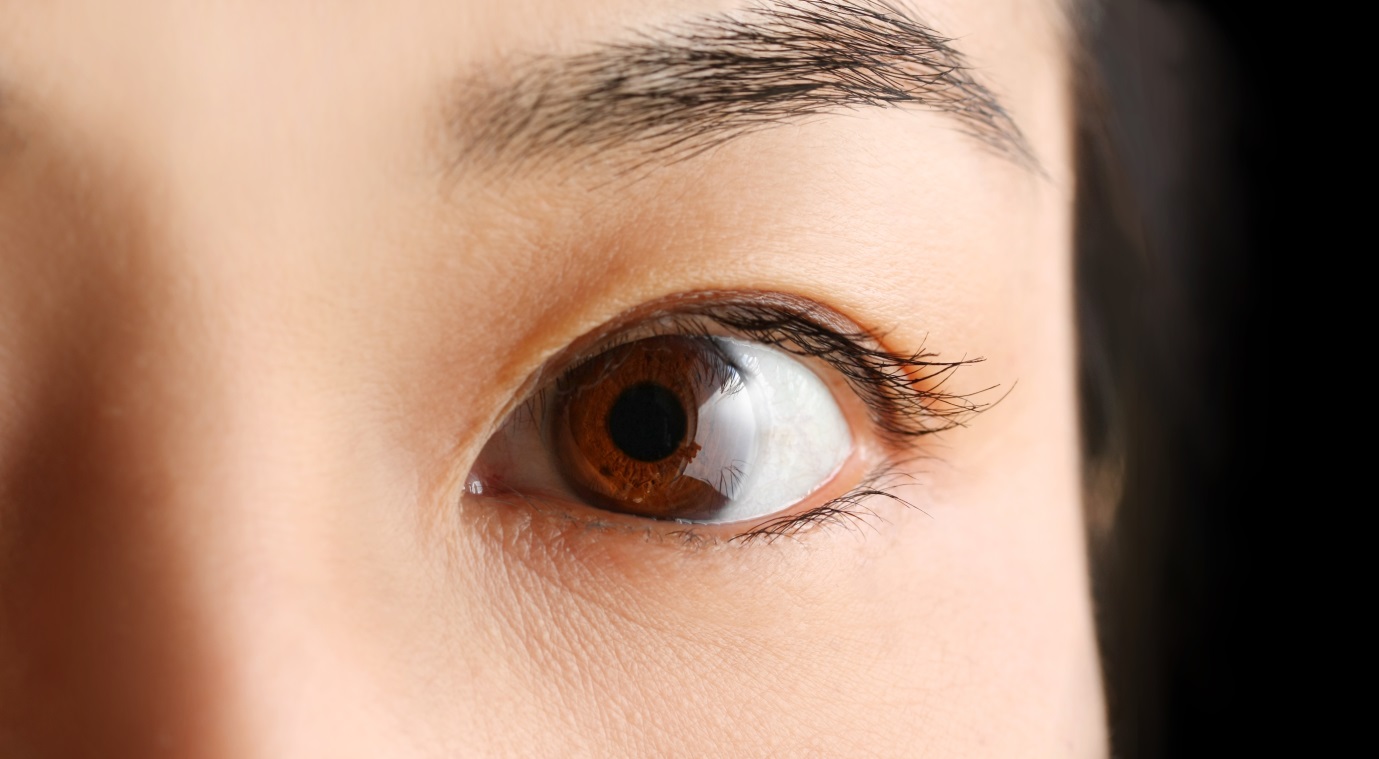 eye2
