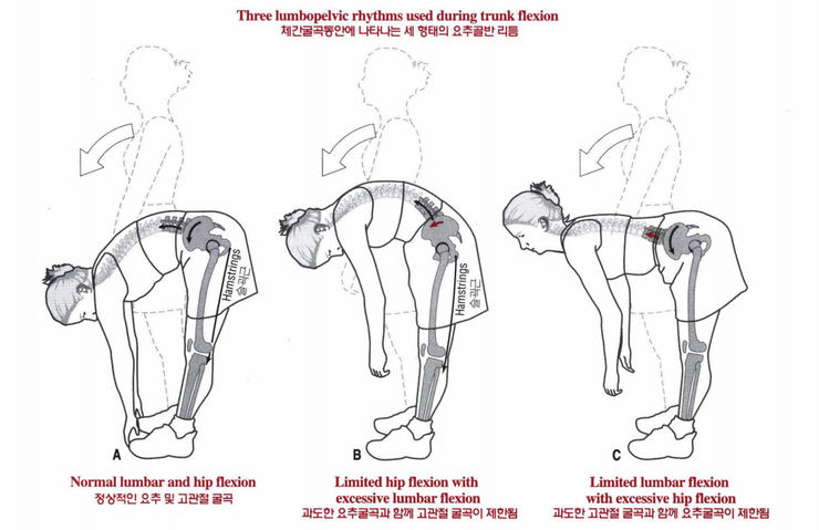 허리 통증 : 허벅지 스트레칭의 중요성에 대하여 | ㅍㅍㅅㅅ