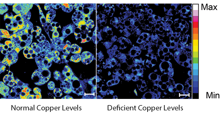 A fluorescent probe creates a heat map of copper in white fat cells. Higher levels of copper are shown in yellow and red. The left panel shows normal levels of copper from fat cells of control mice, and the right panel shows cells deficient in copper. Credit: Lakshmi Krishnamoorthy and Joseph Cotruvo Jr./UC Berkeley